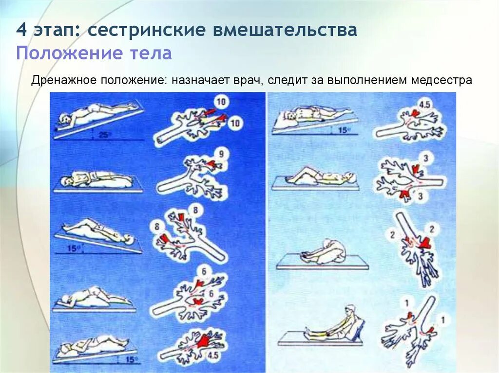 Дренажное положение