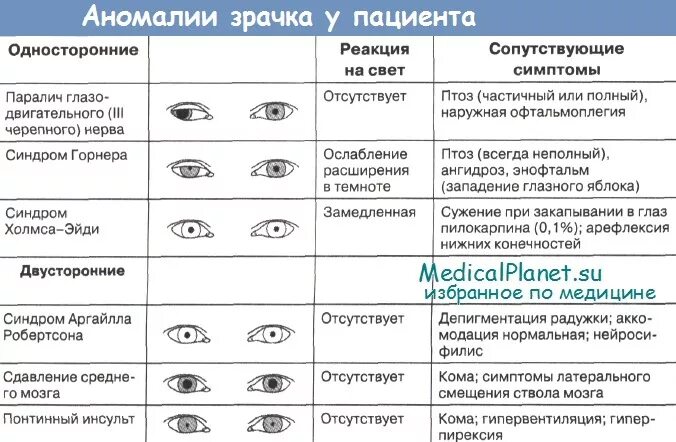 Резкая реакция на свет. Нарушение реакции зрачков на свет. Норма расширения зрачка. Расширение зрачка схема.