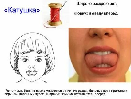 Раскрой рот