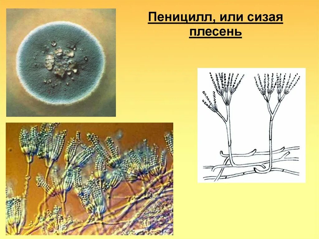 Пеницилл мукор спорынья. Плесневый гриб пеницилл. Спорангии пеницилла. Плесневого грибка рода Penicillium. Строение плесени пеницилл.