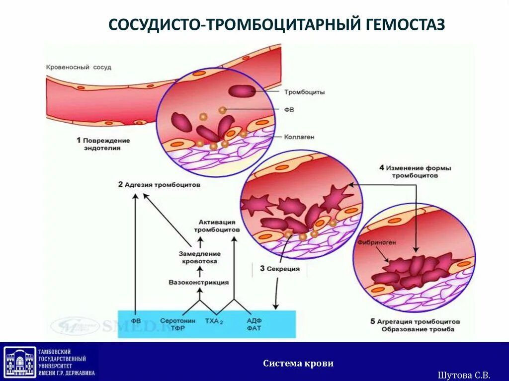Схема «механизмы гемостаза сосудисто тромбоцитарный. Сосудисто-тромбоцитарный (микроциркуляторный) гемостаз. 2 Стадия сосудисто тромбоцитарного гемостаза. Схема тромбоцитарного и коагуляционного гемостаза. Факторы образования тромба