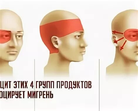 Причины головной боли. Причины головной боли. Локализация головной боли и причины. Схема болей в голове. Локализация глазной боли.