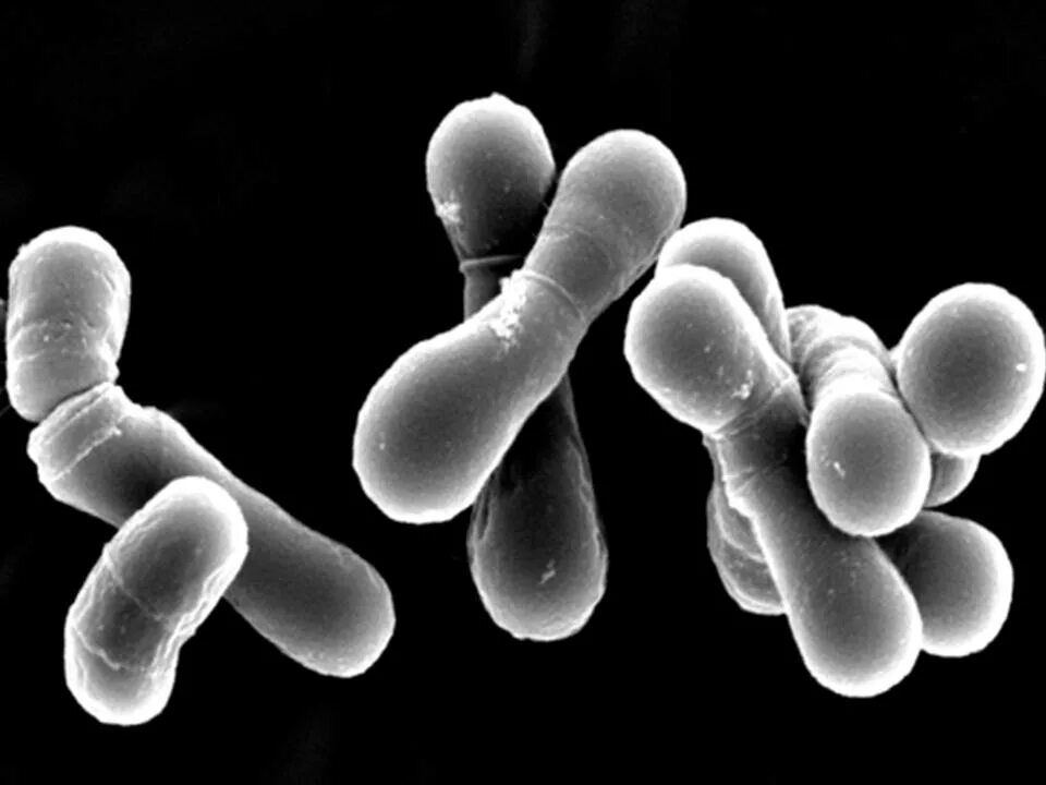 Палочка бифидобактерии. Бифидобактерии lactis. Bifidobacterium animalis subsp. Lactis. Бифидобактерии и энтерококки. Lactobacterium сucemeris.