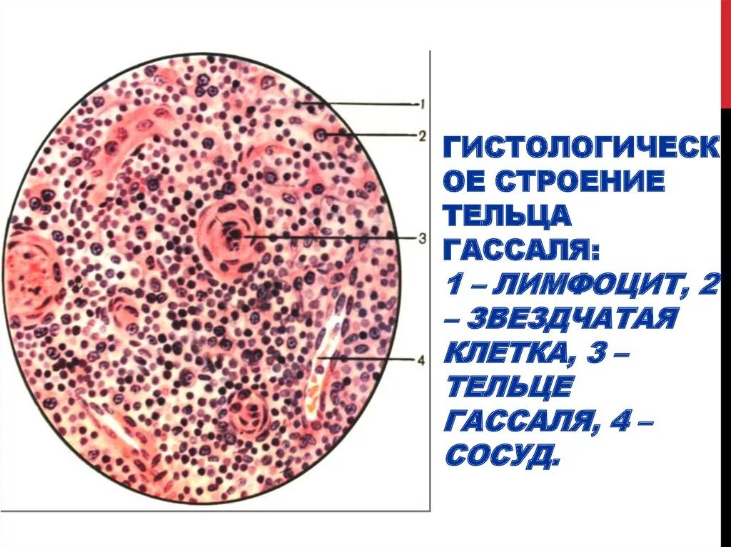 Акцидентальная инволюция тимуса. Клетки гассаля. Тимус тельца гассаля препарат. Тельце гассаля гистология. Клетки гассаля.