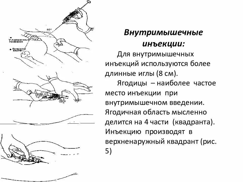 Введение иглы при внутримышечной инъекции. Алгоритм проведения ВМ инъекции. Внутримышечная инъекция алгоритм. Алгоритм инъекции внутримышечной инъекции. Техника выполнения внутримышечной инъекции алгоритм.