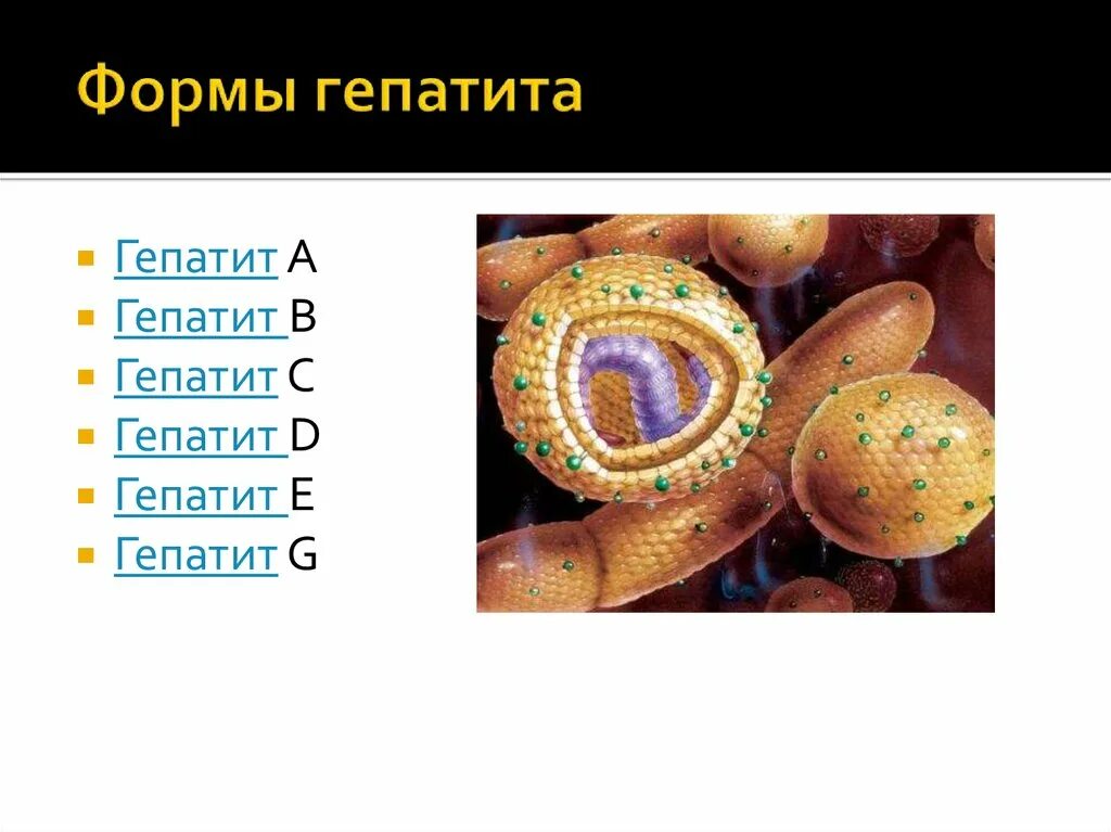 Какая форма гепатита. Формы гепатита. Гепатиты их формы. Какие формы гепатита бывают. Гепатит g.