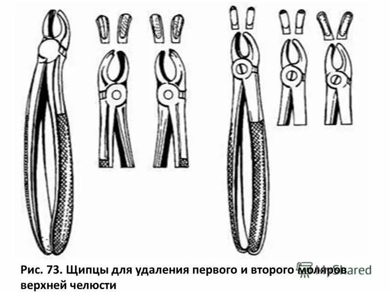 Какими щипцами удаляют зубы