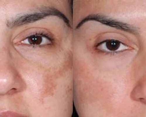 пилинги prx-t33. пилинг 33 отзывы. Prx-t33. пилинг 33 отзывы. пилинг rx33.