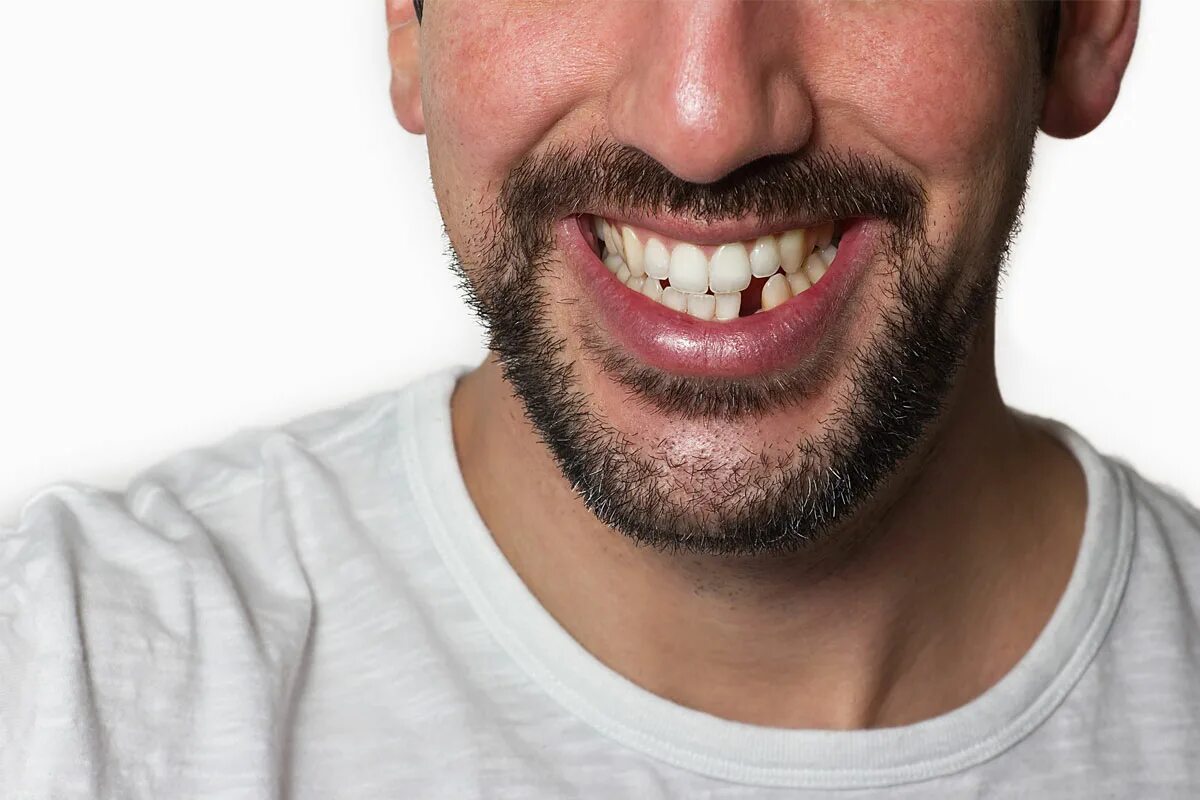 выпадение молочных зубов. к чему снится что растет новый зуб. к чему снится что растет новый зуб. молочный передний нижний резец. зубы из жемчуга.