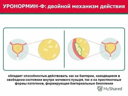 Воспаление слизистой мочевого