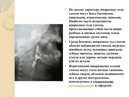 Инородными телами могут быть
