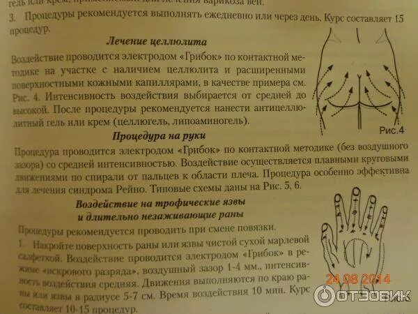 Как правильно делать дарсонваль. Как использовать дарсонваль от целлюлита. дарсонваль от целлюлита как применять. аппарат дарсонваль от целлюлита. аппарат дарсонваль при целлюлите.