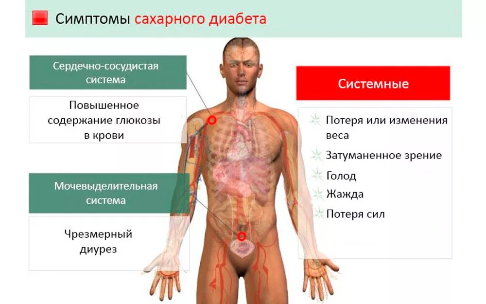 Мужчина 40 лет сахарный диабет