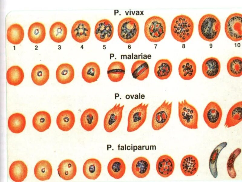 Изменение свойств эритроцитов при тропической малярии. Трофозоит малярийного плазмодия. Малярийный плазмодий формы в эритроцитах. Эритроцитарные формы малярийных плазмодиев отличия. Малярийный плазмодий Тип.
