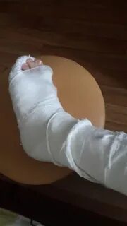 Год гипс