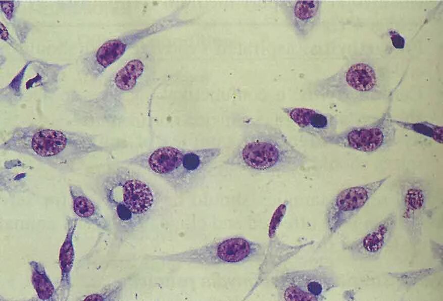 Chlamydia trachomatis. Хламидиоз микроскопия мазка. Хламидия трахоматис под микроскопом. Урогенитальный хламидиоз микроскопия.