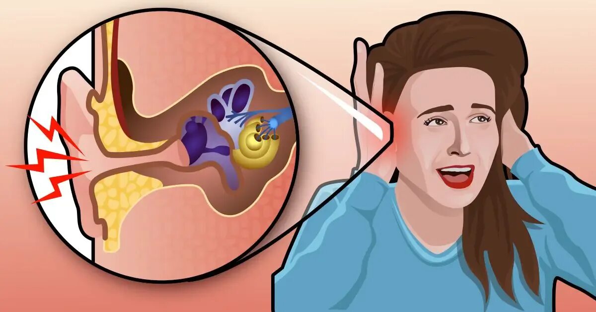 Звук от зубной боли. Что такое в ухе тиннитус. Шум в ушах картинки.