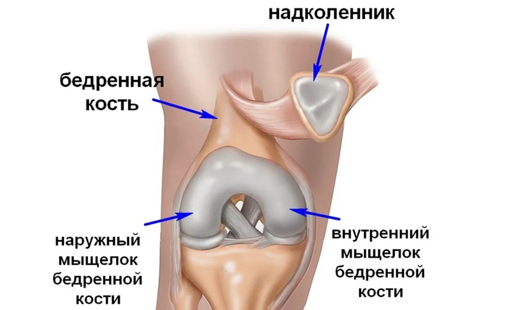 Мыщелок колена. Перелом латерального мыщелка бедренной кости без смещения. Медиального мыщелка бедренной кости. Надколенника перелом латеральный. Строение надколенника человека.