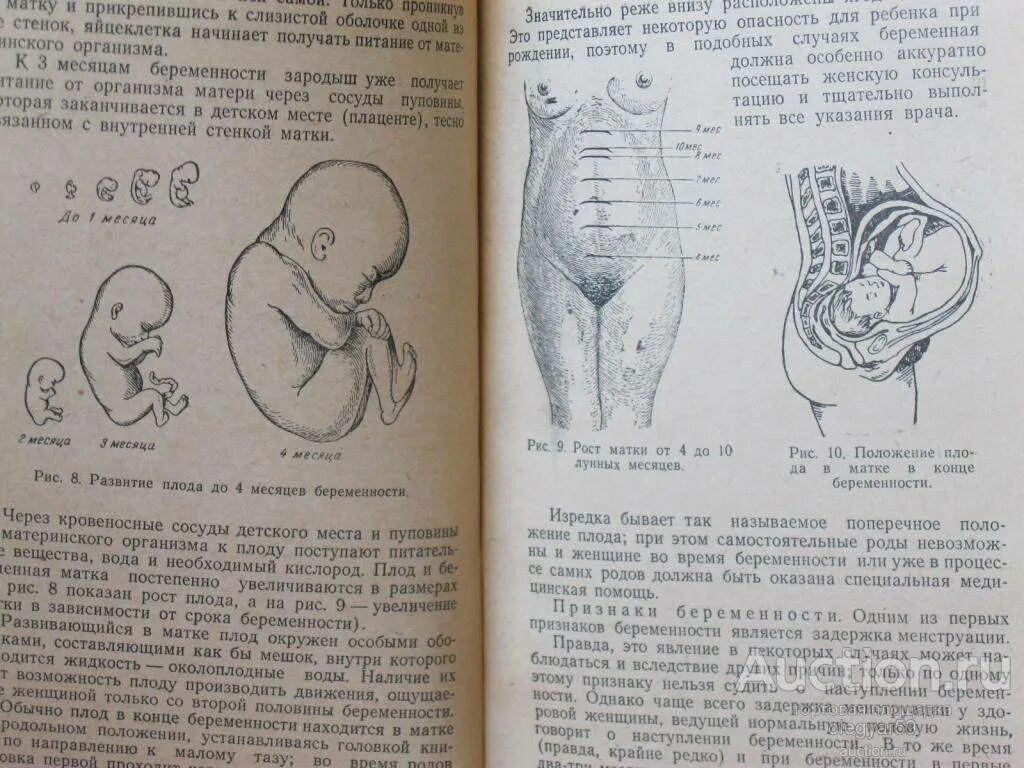 Положение плода в матке по месяцам. Положение ребенка в животе. Расположение плода в животе по неделям. Первые шевеления плода. На каком сроке ощущается