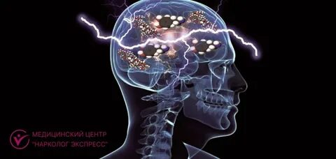 Электрические мозги