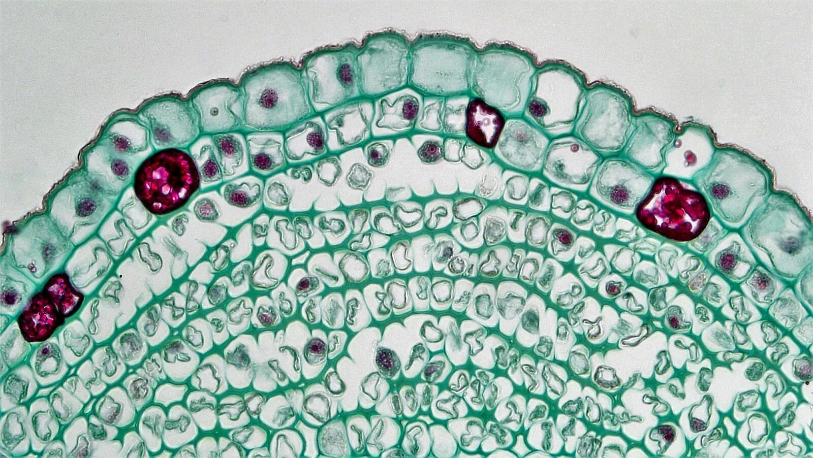 К образованию какой структуры приводит суберинизация. Пробка растений под микроскопом. Суберин у растений. Опробковение клеток. Суберин в клеточной стенке.