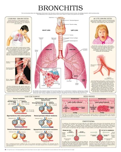Бронхит латынь. Бронхит памятка. Профилактика бронхита. Бронхит плакат. Памятка по бронхиту у детей.