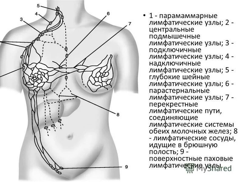 Какой лимфоузел при раке молочной железы. Какой лимфоузел при раке молочной железы