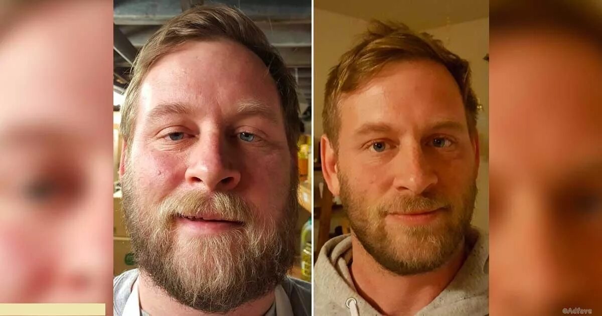 Курящие до и после. Внешность алкоголика до и после. Лицо до и после алкоголизма. Алкогольное лицо мужчины.