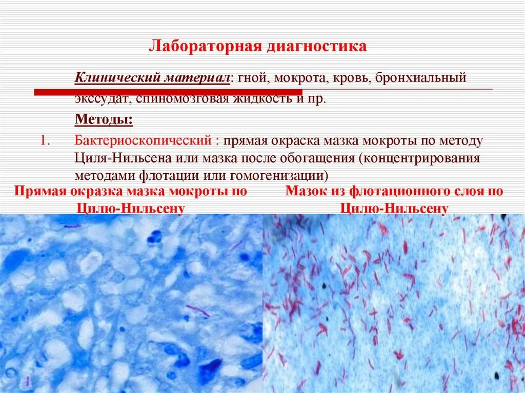 Мокрота на вк. Исследование мокроты по Цилю-Нильсену. Метод микроскопии мазка по Цилю-Нильсену. Микроскопия мокроты по Цилю-Нильсену. Окраска мокроты по Цилю-Нильсену.