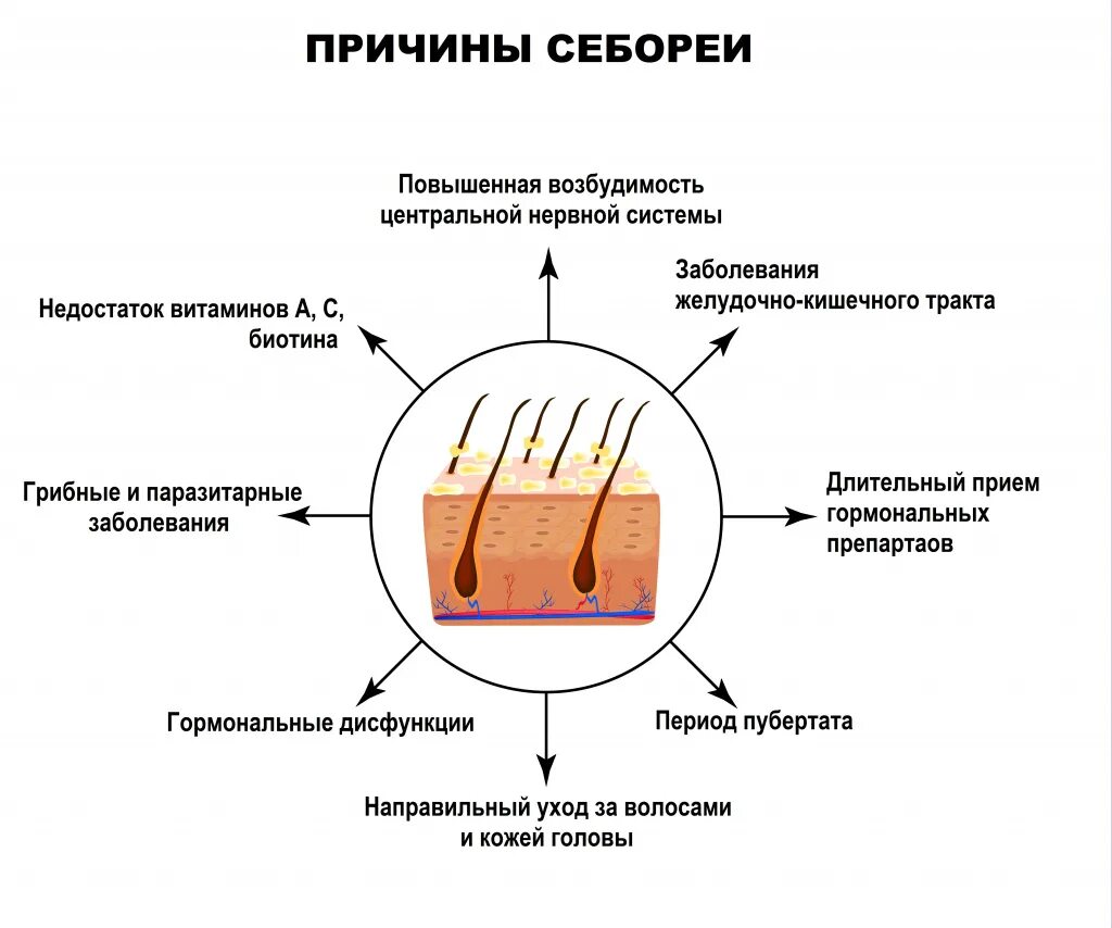 Почему волосы становятся жирными. Жирные волосы причины. Основные причины себореи. Повышенная жирность кожи и волос.