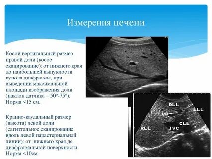 Норма печени на узи у детей