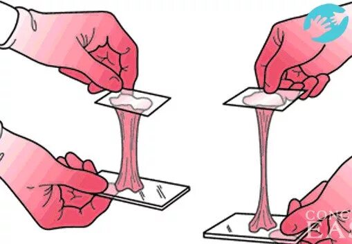 цервикальный метод