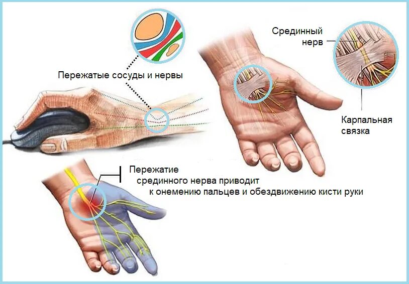 Боль между большим