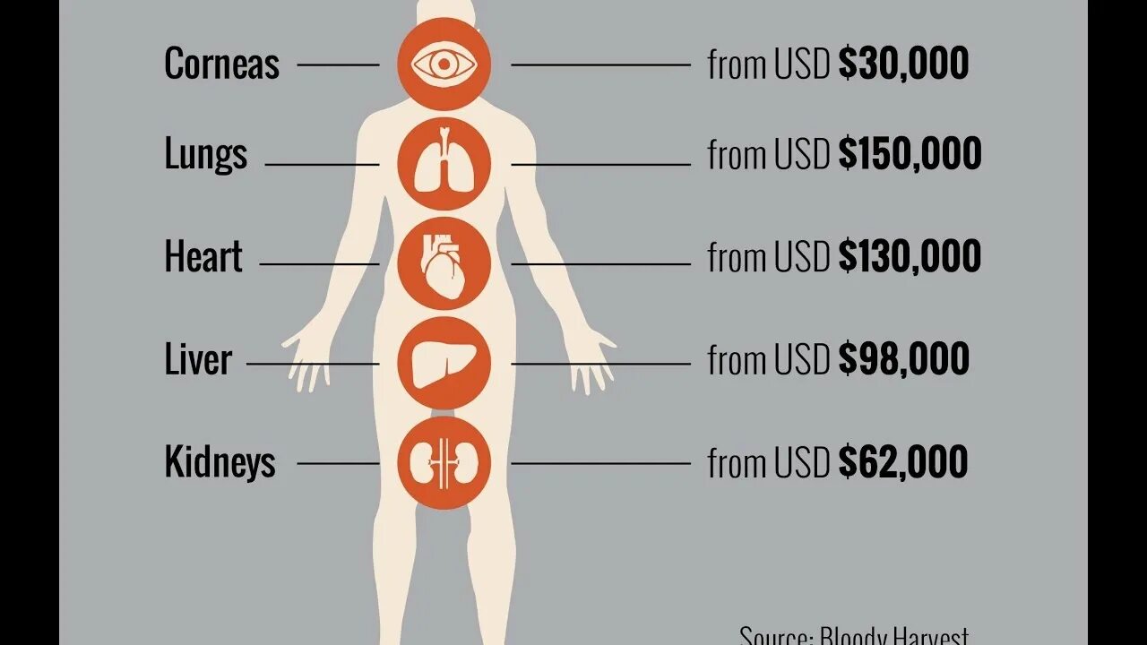 Продажа органов человека. Сколько стоят органы человека. Стоимость человеческих органов. Сколько стояторганв. Стоимость человека на черном рынке.