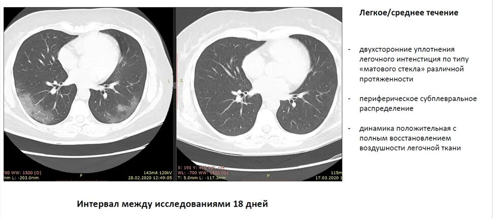 Участок уплотнения по типу матового стекла