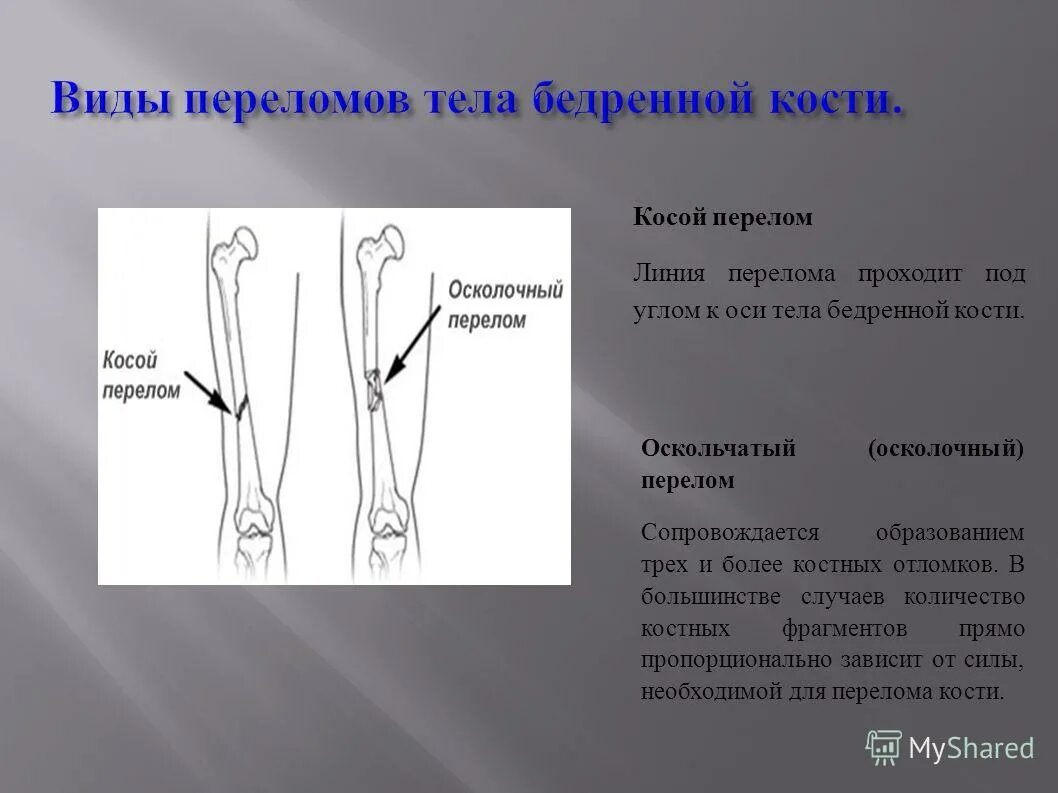 Виды трещин