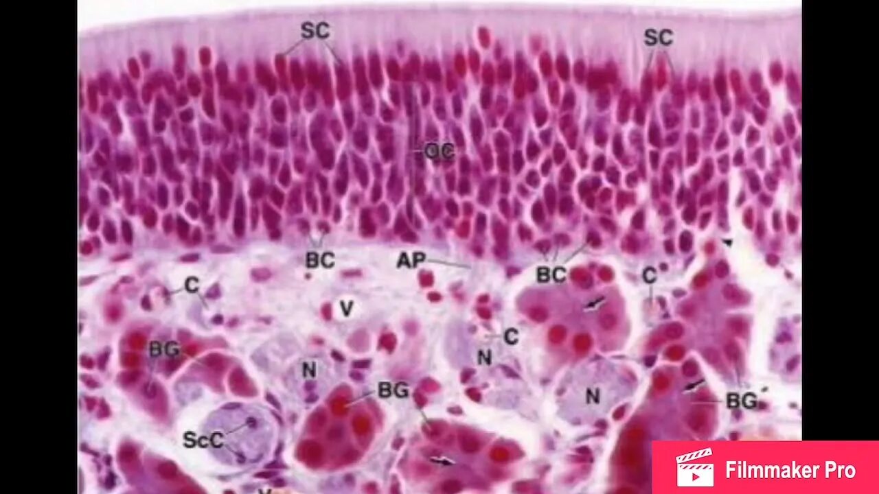 почечный эпителий в моче микроскопия. почечный эпителий. эпителий плоский 1-3 в моче у женщин норма. почечный эпителий в моче под микроскопом. анализ эпителиальные клетки.
