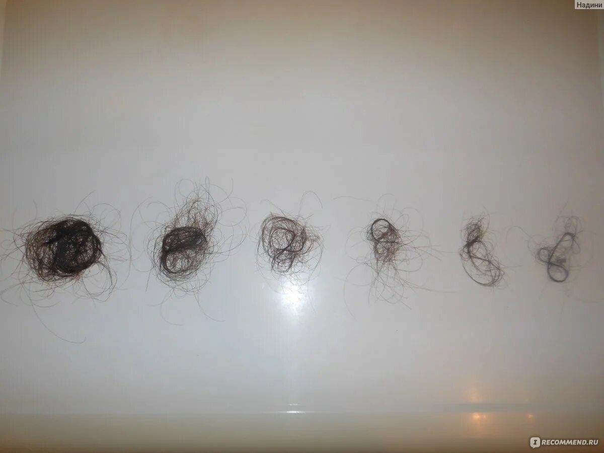 Сколько волос есть у человека. Норма выпадения волос в день. Норма выпадения волос у женщин. Норм норма выпадения волос.