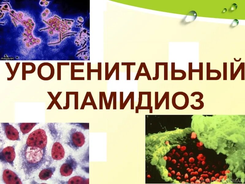 Хламидиоз способы. Хламидии - возбудители урогенитальных инфекций. Хламидиоз клинические проявления. Урогенитальный хламидиоз проявления. Симптомы урогенитального хламидиоза.