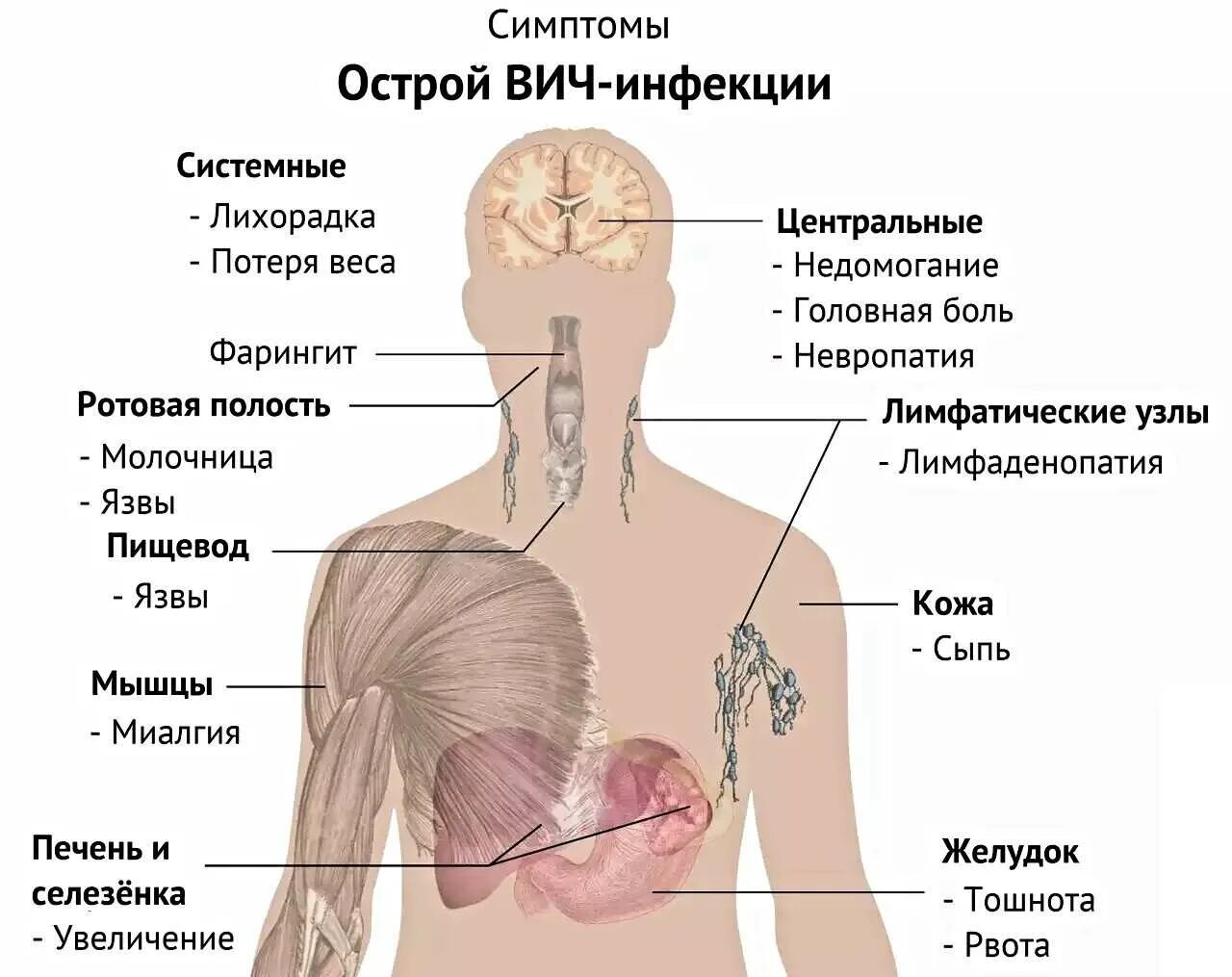 Спид проявляется через. Симптомы СПИДА ВИЧ инфекции. Первичные клинические проявления ВИЧ инфекции. ВИЧ симптомы у мужчин первые.