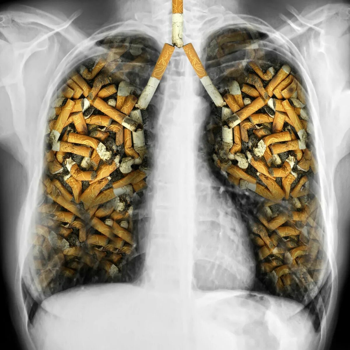 Организм после сигарет. Табакокурение. Курение табака.