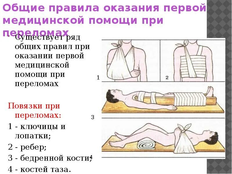 Позы при переломе бедра лежа на кровати для сна. Транспортировка больного при травме грудной клетки. Иммобилизация при компрессионном переломе позвоночника. Иммобилизация плечевого сустава и плеча. Как правильно спать при переломе.