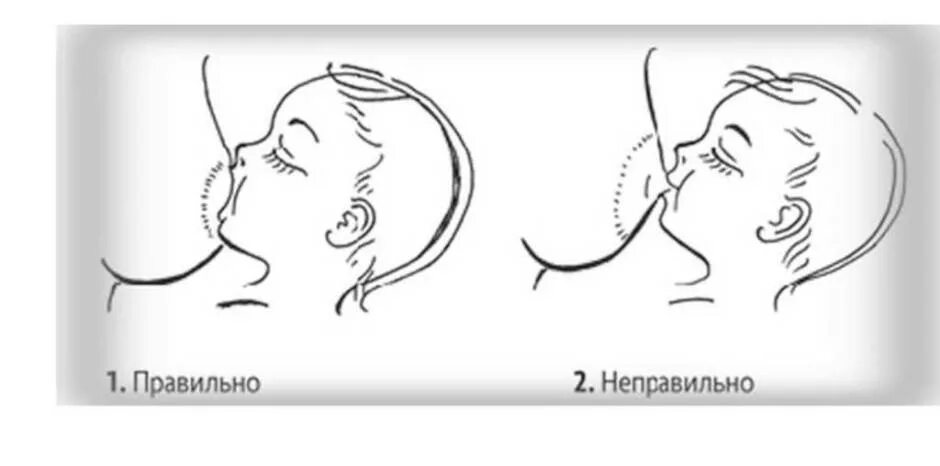 Неправильный захват. Правильное прикладывание при грудном вскармливании. Техника прикладывания ребенка к груди. Грудное вскармливание новорожденных правильное прикладывание. Кормление грудью правильное прикладывание.