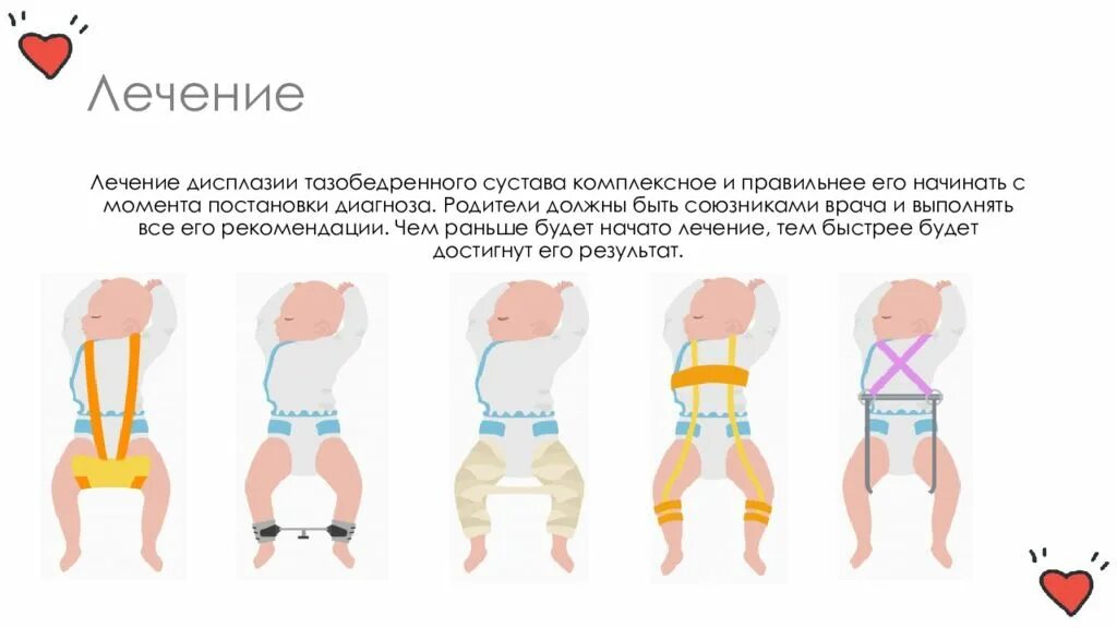 Дисплазия тазобедренных суставов у детей форум. Дисплазия тазобедренных суставов у детей форум