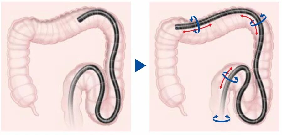 Ободочная кишка анатомия человека. Анатомия толстого кишечника человека атлас. Изгиб сигмовидной кишки. Изгиб кишечника. Отделы толстого кишечника ректосигмоидный.