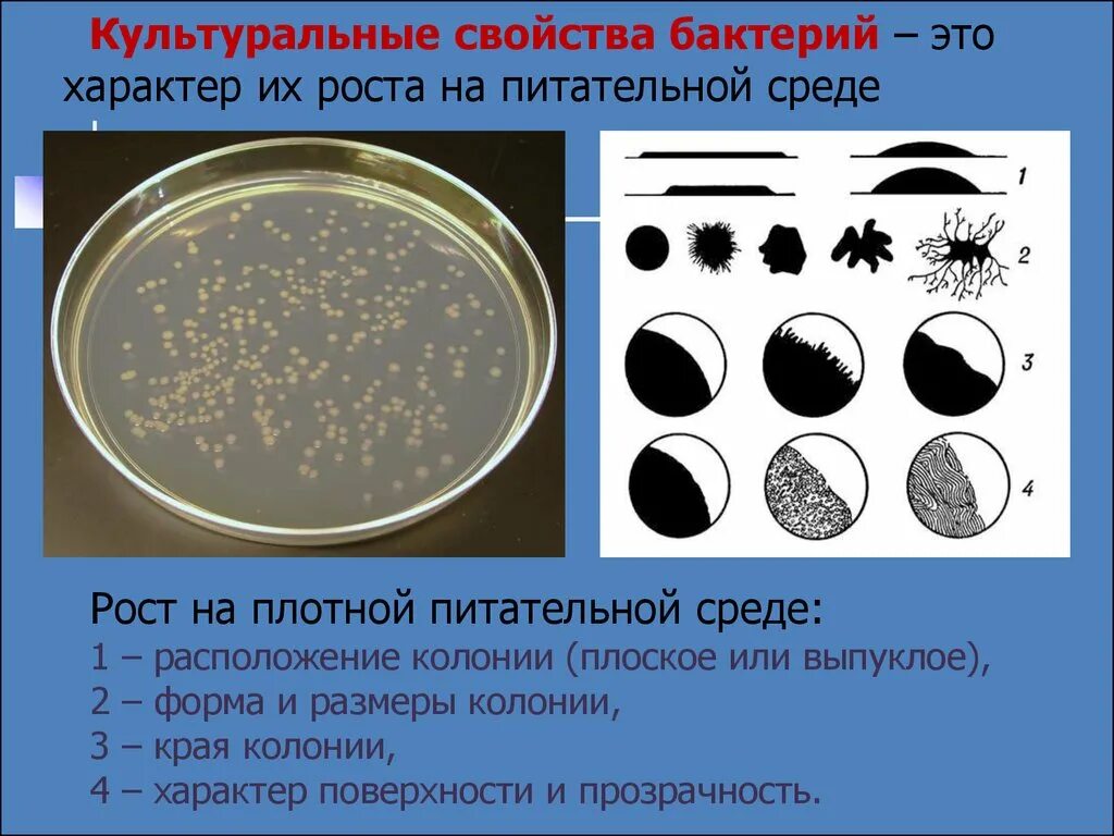 Рост на плотных питательных средах , морфология колоний. Культуральные свойства бактерий на жидкой питательной среде. Формы колоний микроорганизмов на плотных питательных средах. Культуральные свойства микроорганизмов методы.