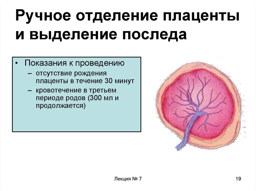 Что такое плацента и какова ее функция. Показания к операции: ручное отделение плаценты. Показания к ручному отделению плаценты. Показания для ручного отделения последа. Ручное отделение плаценты и выделение последа.