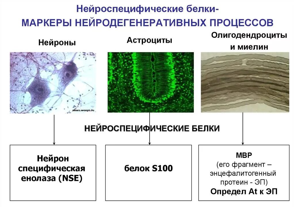Белок нервной ткани. Специфические белки нервной ткани. Протеолипиды. Специфические белки нервной ткани. Нейроспецифические белки нервной ткани.