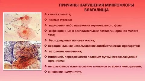 Жжение во влагащение после акта причины