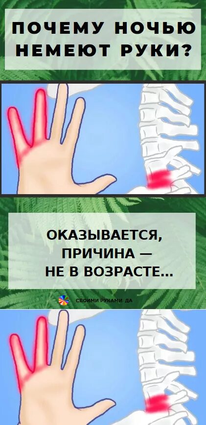 Почему немеет левая рука что делать. Немеют руки. Онемение пальцев рук причины. Немеют руки причина.